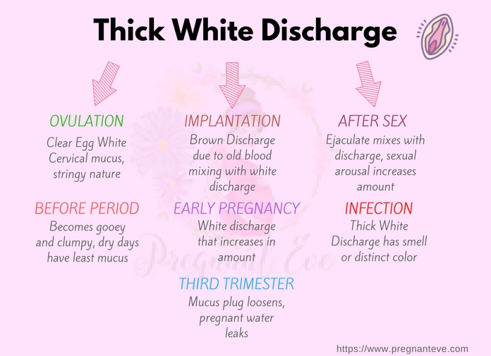 white discharge reason